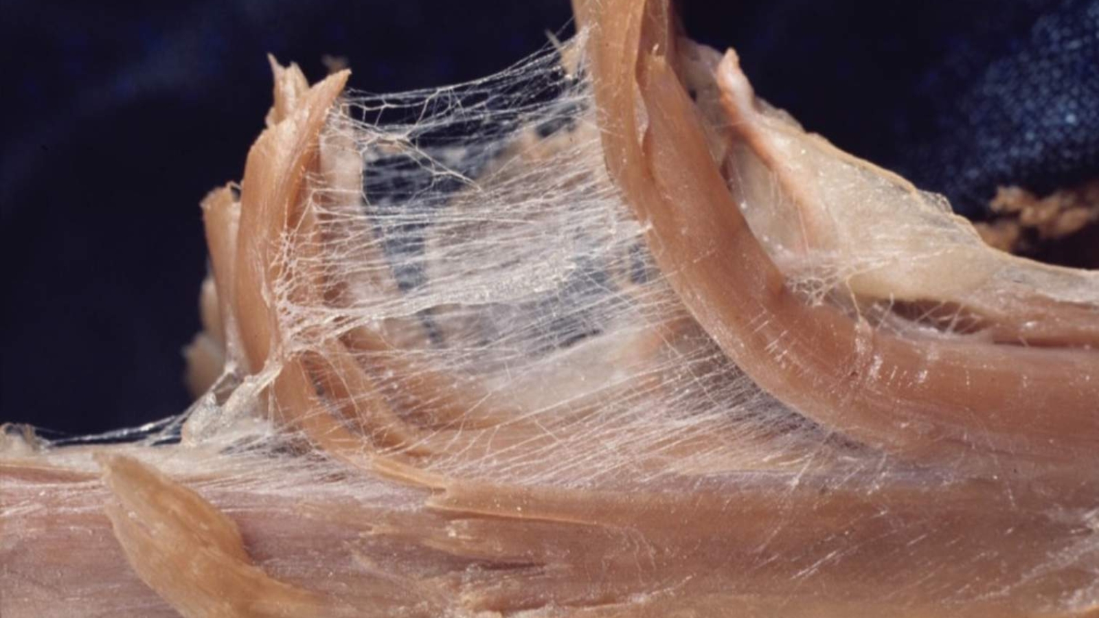 Centro Chinesys, Studio di Chinesiologia e Posturologia a San Benedetto del Tronto, Ascoli Piceno, Fermo e Teramo